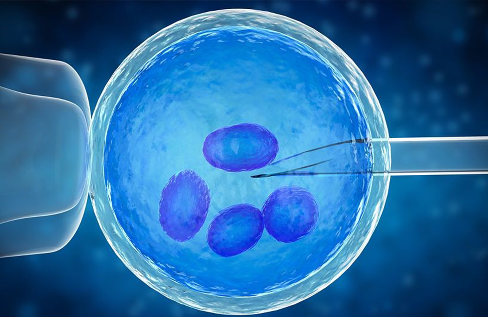 IVF